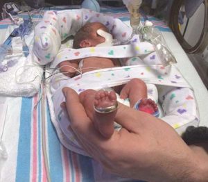 Born at 26.5 weeks gestation, Max McKeown weighed 2.3 pounds – so small the wedding ring of his father, Patrick, encircled his foot. He spent 97 days in the neonatal intensive care unit at Aurora Women’s Pavilion, West Allis. (Submitted photo courtesy Patrick McKeown)